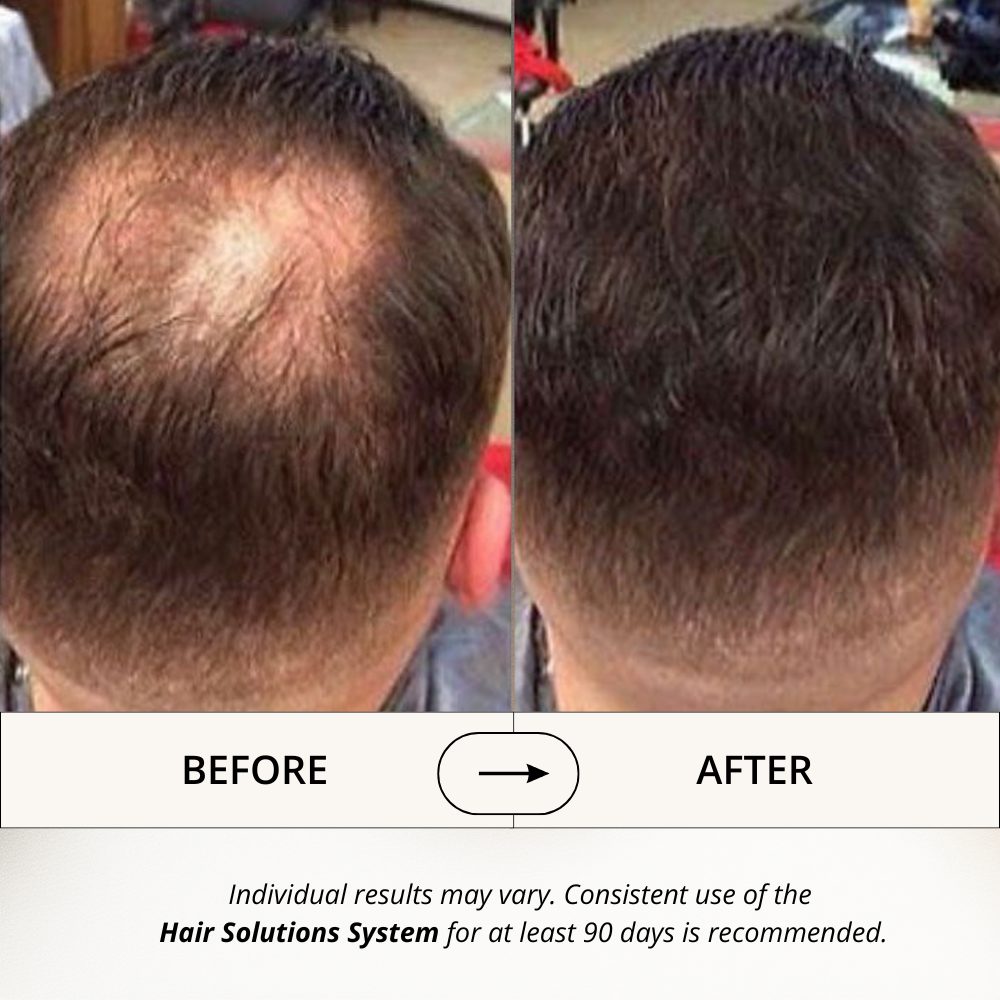 Hair Solutions | Energizing Scalp Serum for Hair Growth