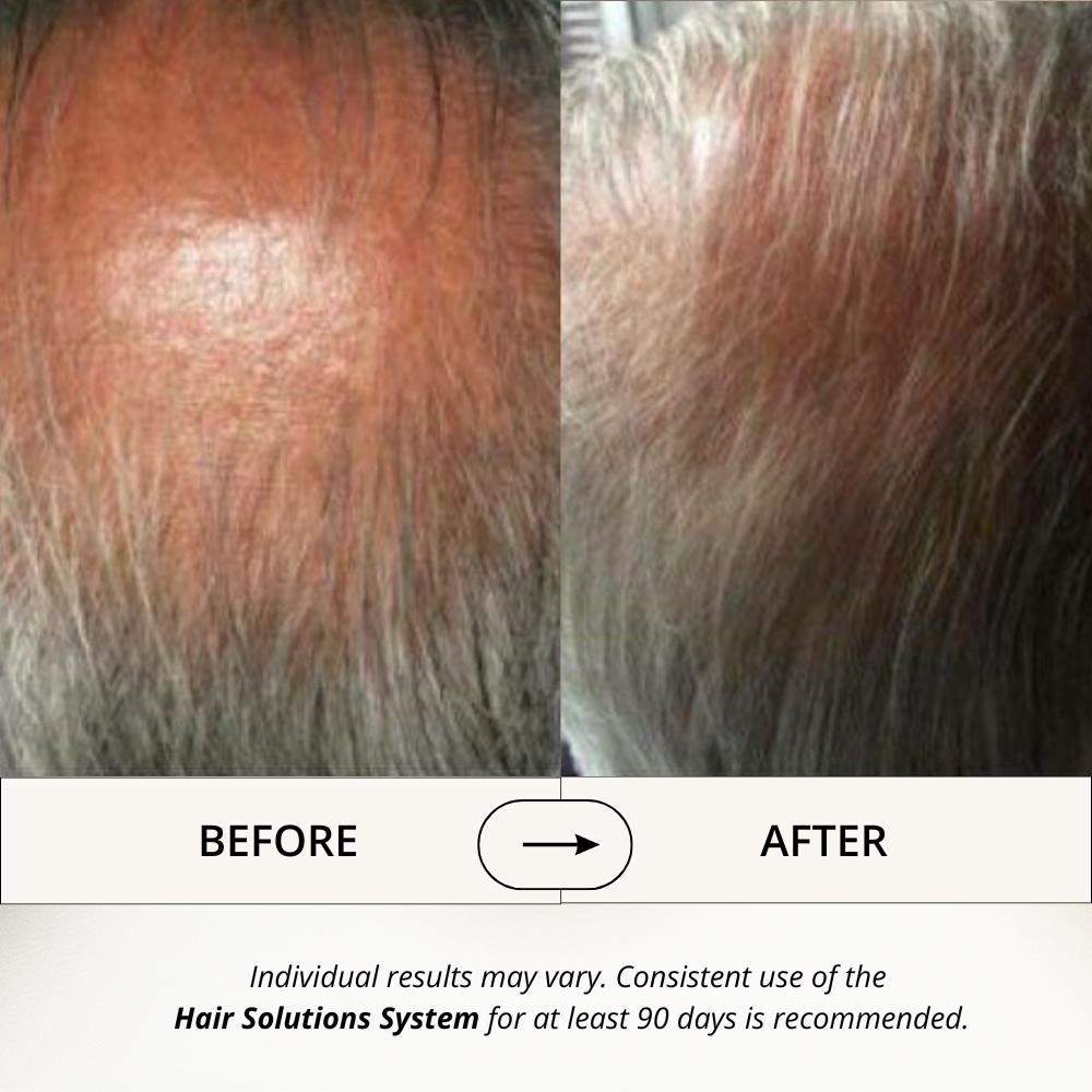 Hair Solutions | Energizing Scalp Serum for Hair Growth